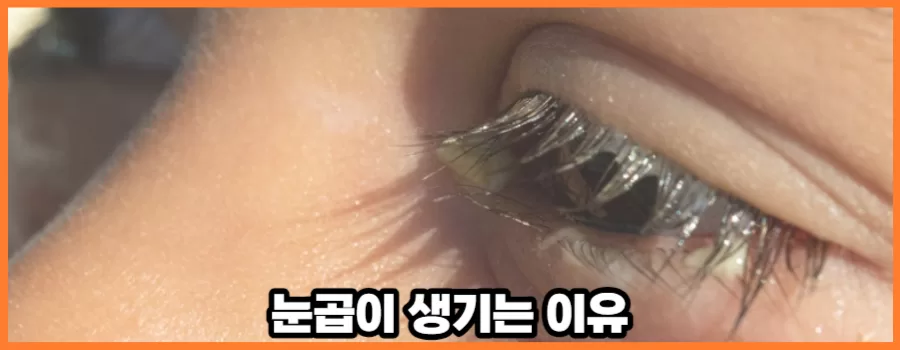 사람들이 잘모르는 눈곱 생기는 이유