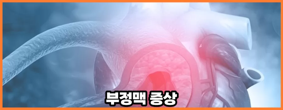 부정맥 증상에 대해서