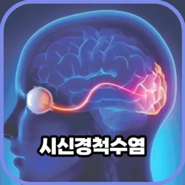 실명 위험성이 있는 시신경척수염