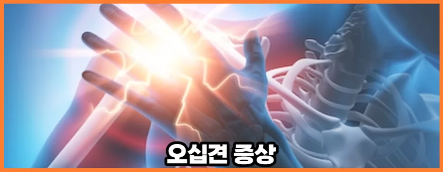 오십견 증상과 치료방법에 대해서