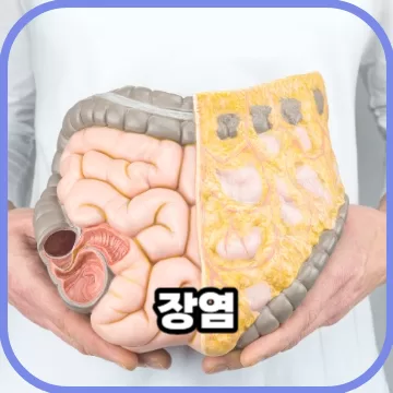 장염 전염이 되는 질병일까